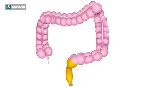 5 dấu hiệu của bệnh viêm trực tràng: Không điều trị sẽ có nguy cơ tiến triển thành ung thư-1