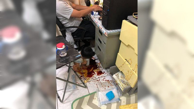 Vừa ra ngoài vài phút, vợ quay về chứng kiến cảnh tượng hãi hùng chỉ muốn nhào đến đốt” chồng-1