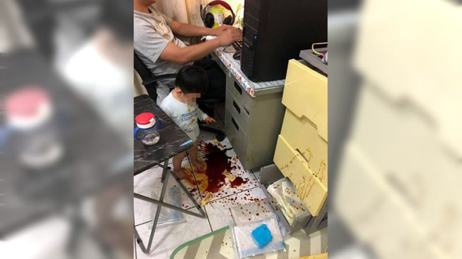 Vừa ra ngoài vài phút, vợ quay về chứng kiến cảnh tượng hãi hùng chỉ muốn nhào đến đốt” chồng-2