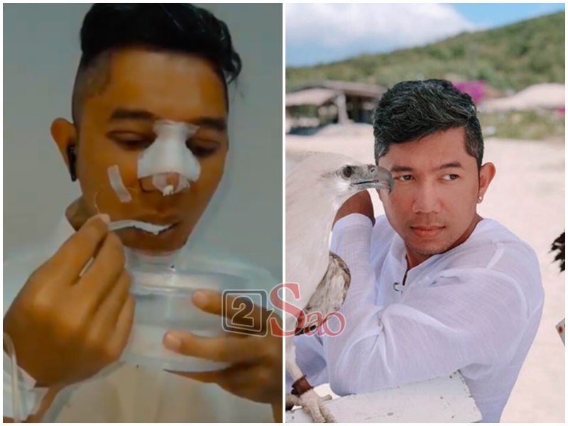 Loạt sao Việt nghiện khoe dung nhan dù biết rõ đẹp nhờ phẫu thuật thẩm mỹ-1