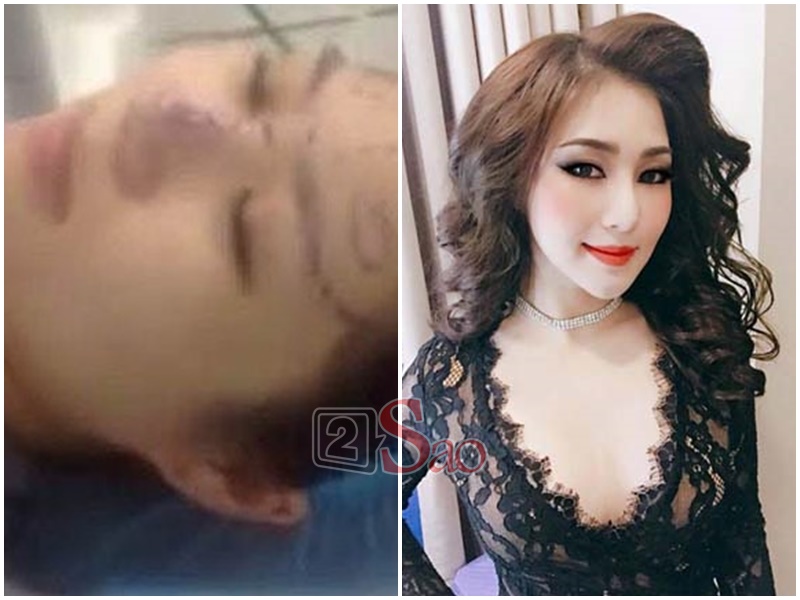 Loạt sao Việt nghiện khoe dung nhan dù biết rõ đẹp nhờ phẫu thuật thẩm mỹ-5