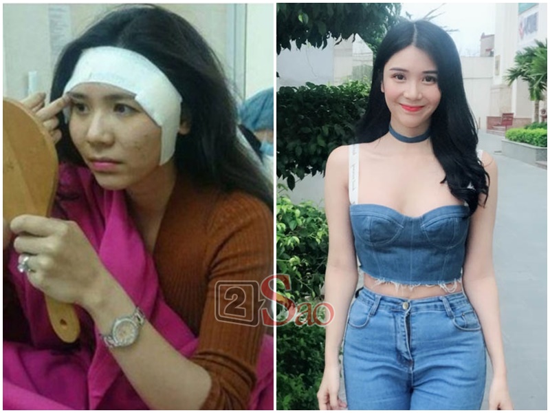 Loạt sao Việt nghiện khoe dung nhan dù biết rõ đẹp nhờ phẫu thuật thẩm mỹ-8