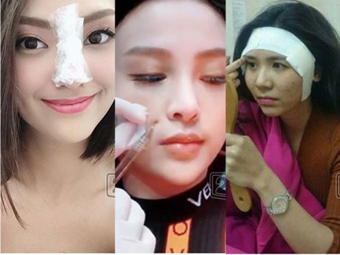 Loạt sao Việt nghiện khoe dung nhan dù biết rõ đẹp nhờ phẫu thuật thẩm mỹ