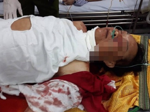 Bắc Giang: Thanh niên tâm thần bị hàng xóm chém 7 nhát vì làm đổ tường gạch và gãy cây cối trong vườn-4