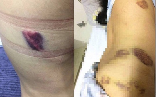 Chuyên viên Sở GD-ĐT Thanh Hóa bị bạn gái” tố hành hung, làm nhục?-2