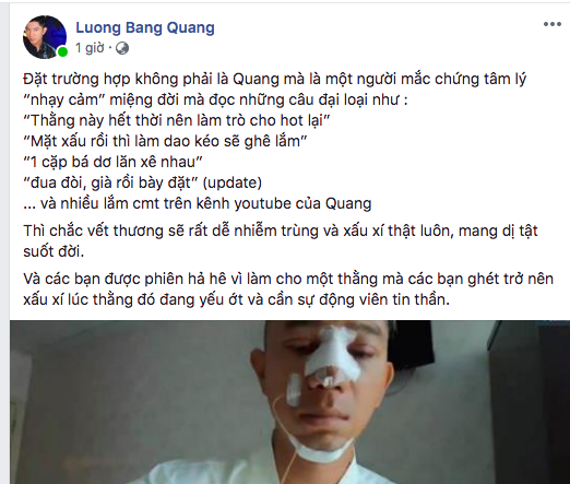 Bị miệt thị vì thẩm mĩ, Lương Bằng Quang bức xúc: Các bạn được phen hả hê vì làm cho một thằng mà các bạn ghét trở nên xấu xí-1