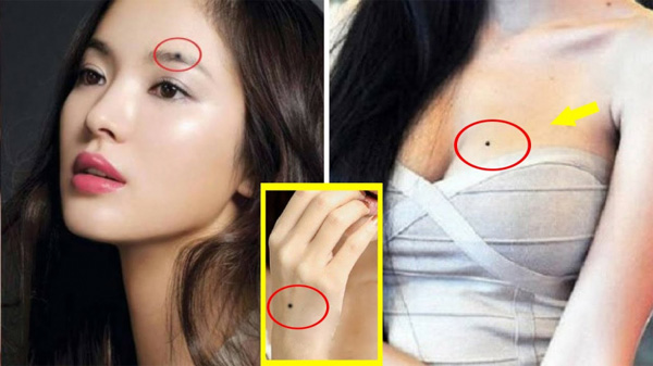 4 nốt ruồi lật ngược số mệnh của phụ nữ, nghèo khổ đến mấy cũng có ngày thành đại gia bạc tỷ-2