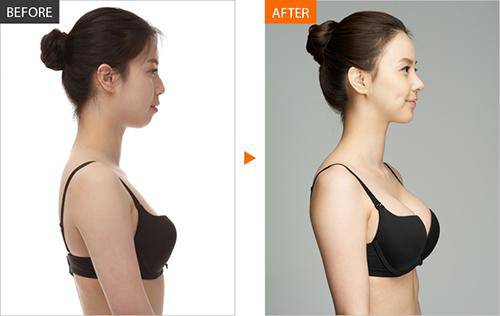 Chẳng cần nâng ngực hay độn vài lớp vẫn có vòng 1 quyến rũ nếu thường xuyên ăn thứ này-9