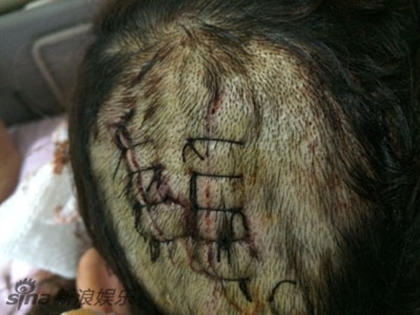 Hoa hậu vàng trong làng tạo nghiệp: thả chó cắn đồng nghiệp, mồi chài Hoắc Kiến Hoa, quỵt tiền của giúp việc-4