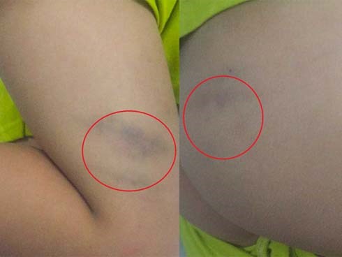 Cô giáo bị phụ huynh tố đánh học sinh: 'Tôi rất ân hận'