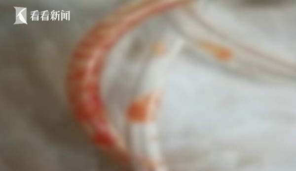 Con trai 15 tháng tuổi tim ngừng đập hơn 40 phút, hôn mê sâu chỉ vì sơ sẩy và phản ứng chậm trễ này của người mẹ-2