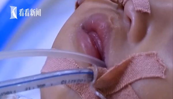 Con trai 15 tháng tuổi tim ngừng đập hơn 40 phút, hôn mê sâu chỉ vì sơ sẩy và phản ứng chậm trễ này của người mẹ-3