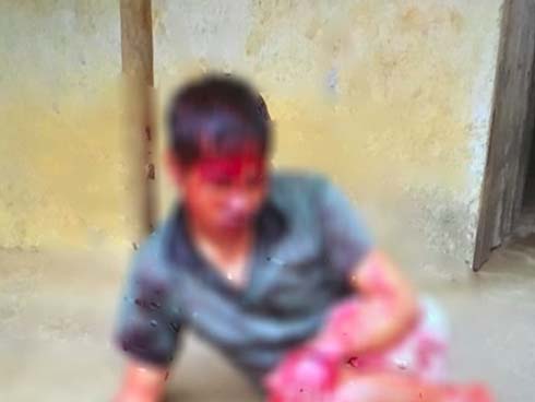 Kinh hoàng nhóm côn đồ lao vào quán bi-a chém người lìa bàn tay-2