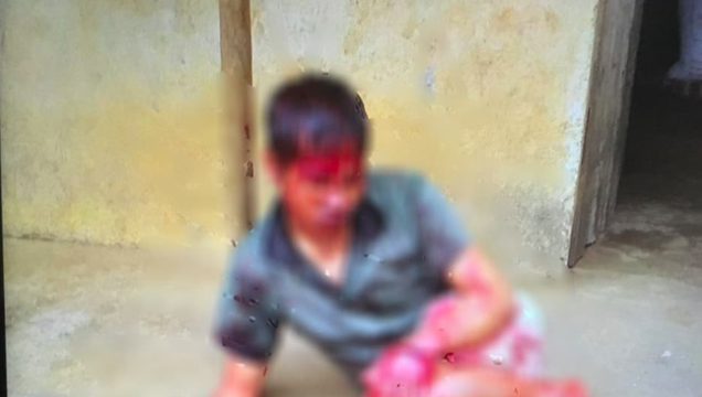 Bắc Giang: Thanh niên tâm thần bị hàng xóm chém 7 nhát vì làm đổ tường gạch và gãy cây cối trong vườn-1