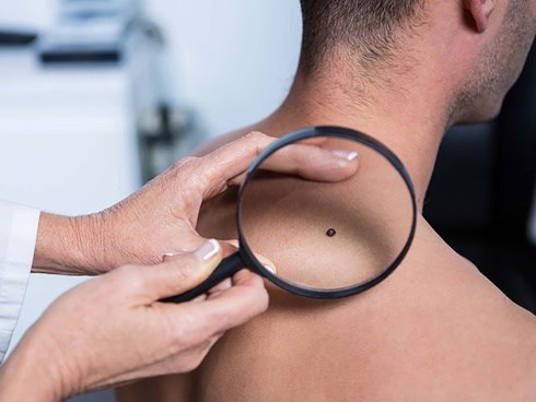 Dấu hiệu cảnh báo ung thư ở nam giới thường bị bỏ qua