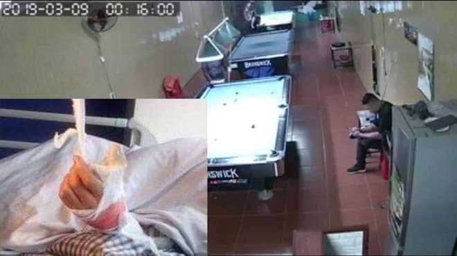 Vụ nam thanh niên bị chém lìa tay: Hé lộ tình tiết bất ngờ từ người thân-1