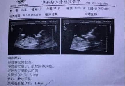 Xôn xao thông tin Dương Mịch đang mang thai sau 3 tháng ly hôn, bố đứa trẻ là diễn viên nổi tiếng-2