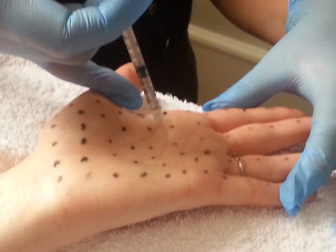 Nếu bạn thường xuyên đổ nhiều mồ hôi, đừng bỏ qua những điều này-3