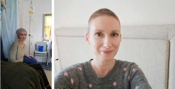 Người phụ nữ 35 tuổi phát hiện mình mắc bệnh ung thư máu từ dấu hiệu mà ai cũng có thể gặp phải trong cuộc sống thường ngày-3