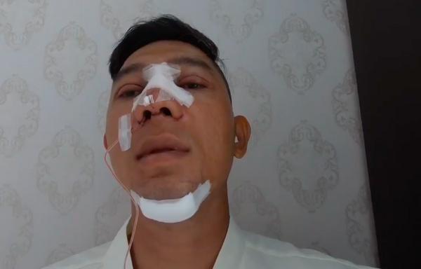 Selfie bên bạn trai với khuôn mặt băng bó chằng chịt, Ngân 98 cũng mới lên đời nhan sắc?-2