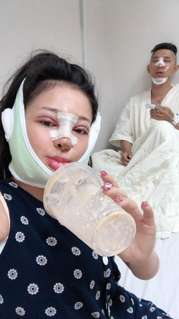 Selfie bên bạn trai với khuôn mặt băng bó chằng chịt, Ngân 98 cũng mới lên đời nhan sắc?-3