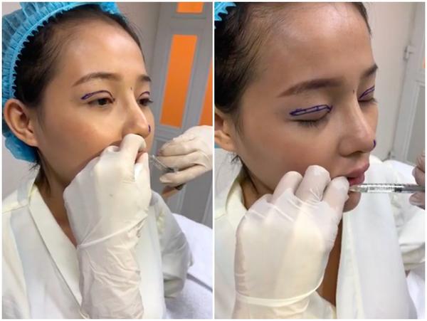 Selfie bên bạn trai với khuôn mặt băng bó chằng chịt, Ngân 98 cũng mới lên đời nhan sắc?-5