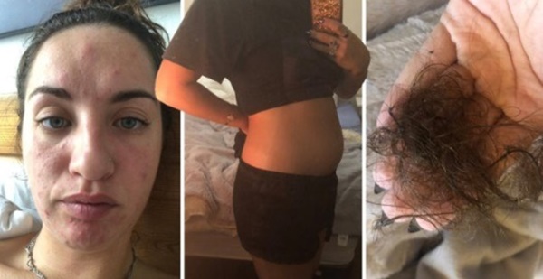 Có thứ này trong nhà nhiều năm, cô gái 29 tuổi bị kiệt sức, mất trí nhớ, rụng tóc và chết dần chết mòn-4