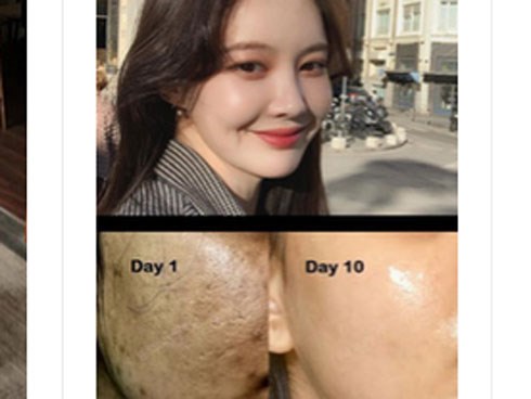 Làn da sẽ hưởng cả tá tác dụng khi lấy đá lạnh lăn lên mặt, nhưng nếu dùng sai cách thì da xấu không cứu vãn nổi