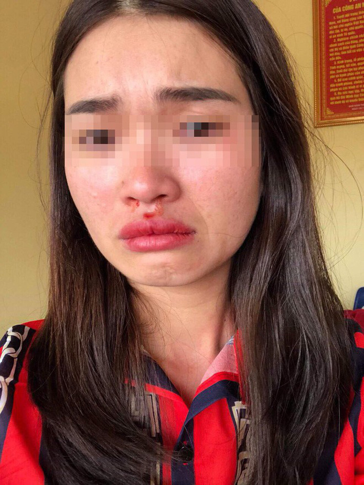 Vụ nữ hành khách bị đánh vì chụp ảnh xe đánh võng: Chiếc ô tô đã bị công an tạm giữ-1