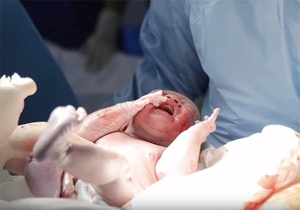 Tung khoảnh khắc con đỏ hỏn được lấy ra từ bụng mẹ, Thanh Thúy khiến nghìn chị em cay mắt-1