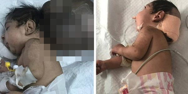 Giải cứu bé sơ sinh 2 đầu sau khi bị chính cha ruột chôn sống-1