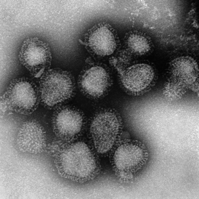 WHO cảnh báo: Đại dịch cúm là thảm họa tiếp theo sẽ xảy ra - Chuyên gia khuyến cáo việc nên làm để phòng bệnh-2