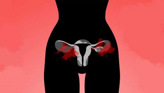 Rốn xuất hiện cục màu đỏ như thế này hóa ra là dấu hiệu cảnh báo bệnh ung thư đáng sợ-4