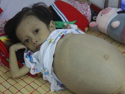 Sau sinh 1 tháng, mẹ bật khóc khi nghe bác sĩ thông báo tình hình sức khỏe của con