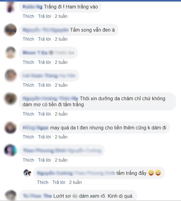 Người nổi đầy gân xanh như trong phim kinh dị, tất cả là bởi phương pháp làm đẹp này-7