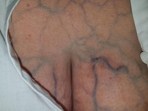 Tá hỏa” với phương pháp đốt lửa lên mặt để làm đẹp da: Chuyên gia lý giải tường tận thông tin ai nghe xong cũng giật mình-5