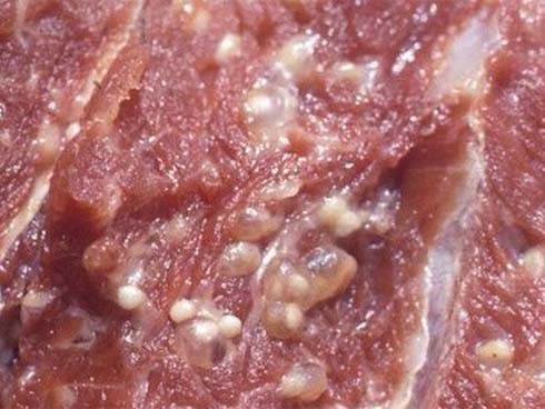 Vụ 400 học sinh mầm non xét nghiệm sán đồng loạt: BS hướng dẫn cách ăn đúng phòng mắc sán-2