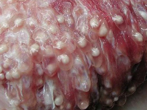 Gần 100 trẻ nhiễm sán lợn ở Bắc Ninh: Thêm hàng trăm trẻ tới Hà Nội xếp hàng để xét nghiệm-3