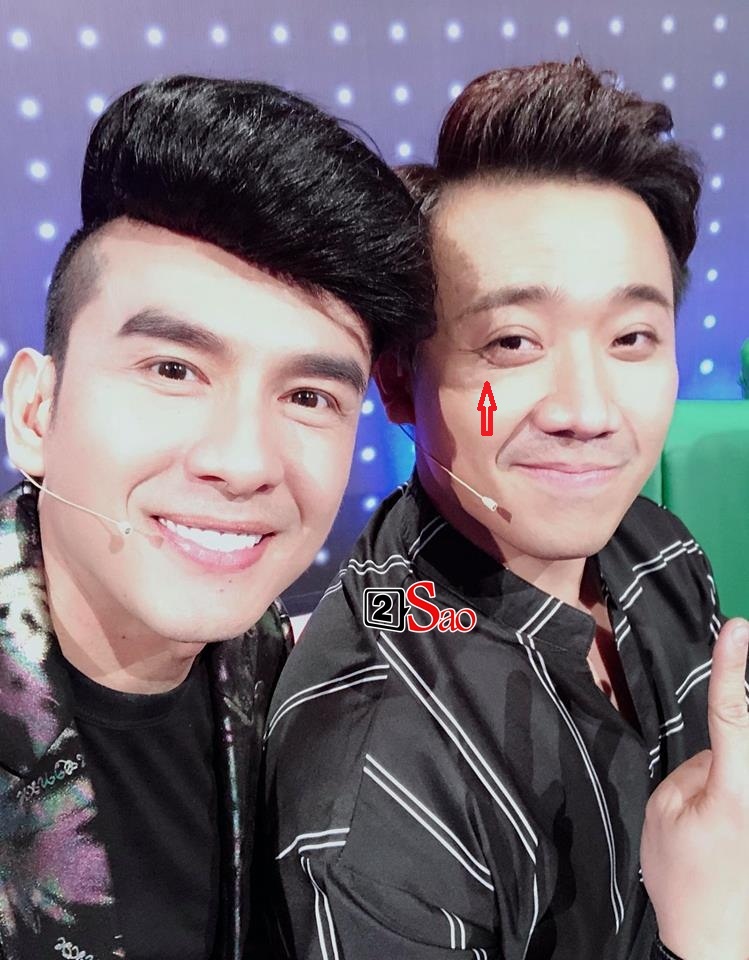 Nhan sắc bị chê tới tấp khi đang livestream, Trấn Thành phản đòn rất tự tin khiến ai cũng đứng hình-4