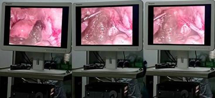 Vụ nữ bệnh nhân bị thắt vòi trứng khi mổ ruột thừa: Giám đốc bệnh viện lên tiếng-2