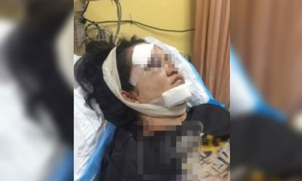 Thấy con gái tốt nghiệp mà vẫn chưa xin được việc, bố đẻ tức tối nện búa vào mặt không thương tiếc-2