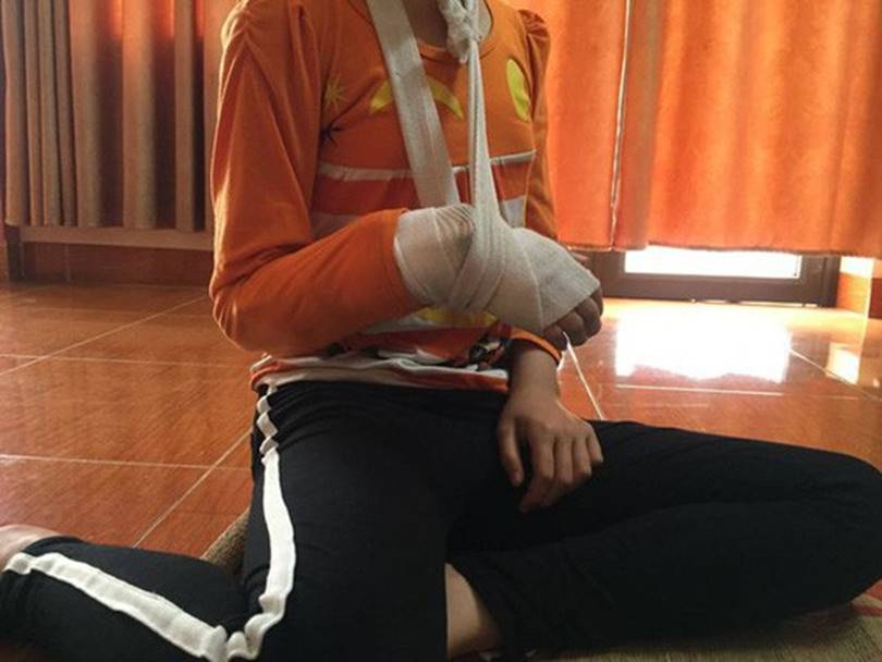 Xâm hại bé gái 9 tuổi đến rạn xương tay: Cho tại ngoại do phạm tội ít nghiêm trọng-1