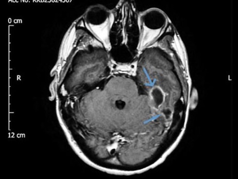 Mất con gái đầu lòng vì căn bệnh vô hại ở người lớn nhưng cực kỳ nguy hiểm với bé sơ sinh-4