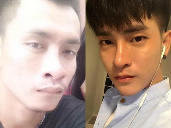 Giới trẻ dao kéo: Người vịt hóa thiên nga, kẻ bị gọi là ác quỷ-2