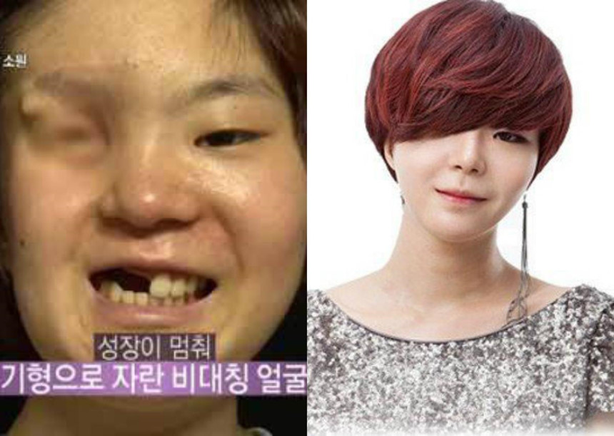 Giới trẻ dao kéo: Người vịt hóa thiên nga, kẻ bị gọi là ác quỷ-3