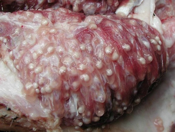 Xét nghiệm sán lợn gây hoang mang vô nghĩa, đây mới là việc cần làm khi nghi ngờ nhiễm sán-1