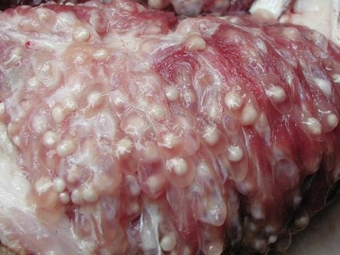 Bà mẹ trẻ chết thảm trên bàn mổ khi phẫu thuật nâng mông-4