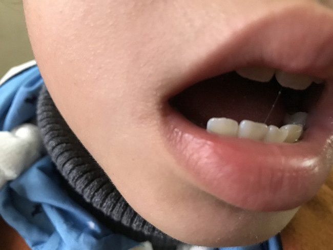 Bé gái 9 tuổi khóc nghẹn kể lại giây phút bị yêu râu xanh dụ ra bụi chuối hãm hại-1