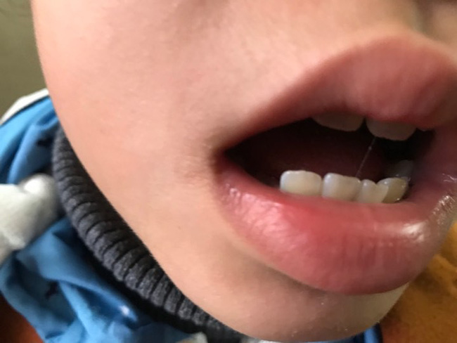 Cha của bé gái 9 tuổi bị hiếp dâm ở vườn chuối: Nhiều người rỉ tai nhau vợ chồng tôi bán con để Trình được thả”-2