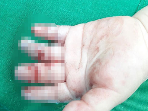 Vệ sinh máy xay thịt, người phụ nữ bị nghiền nát bàn tay-2